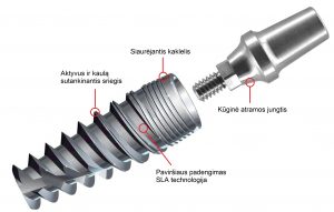 logic implantai