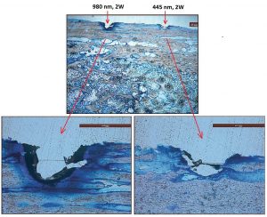980 nm vs 445 nm